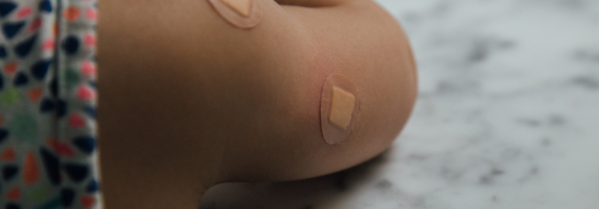 Closeup of child's arm after vaccines with bandaids