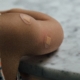 Closeup of child's arm after vaccines with bandaids